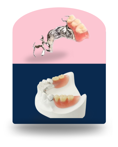 Cobalt Chromium Denture