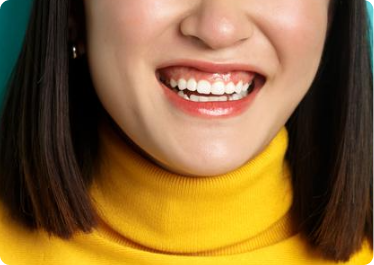 Have excessive or uneven gum growth Have excessive or uneven gum growth