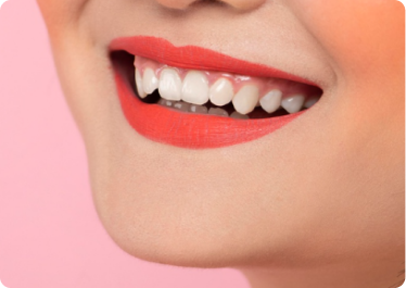 Have a gummy smile Have a gummy smile