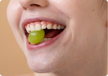 Want aesthetic improvement Want aesthetic improvement