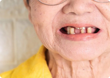 Who is a good candidate for dentures?