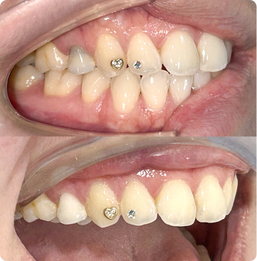 Experience internal stains Experience internal stains