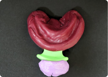 1st Appointment - Consultation, primary impression & bite record