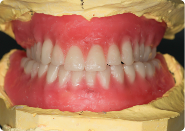 3rd Appointment - Try-in session