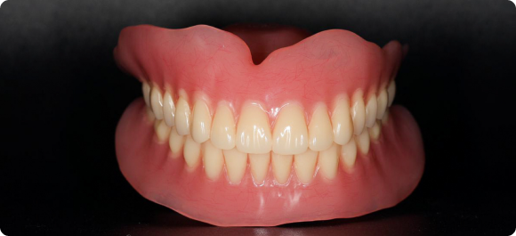 4th Appointment - Final denture fit