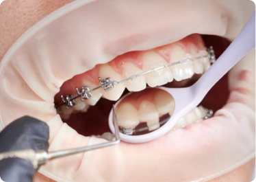 3rd Appointment - Bond up 3rd Appointment - Bond up