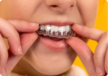 Final Appointment - Retainer issue Final Appointment - Retainer issue