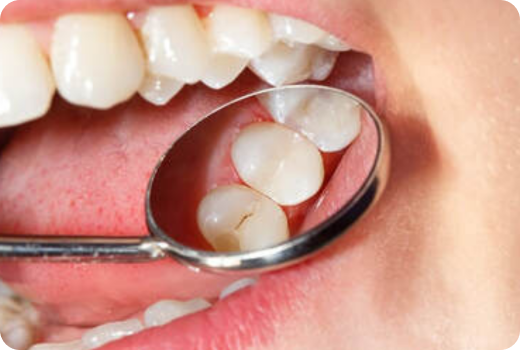 Paediatric Treatments