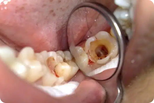 Paediatric Treatments