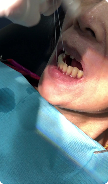 Another suction denture testimonies