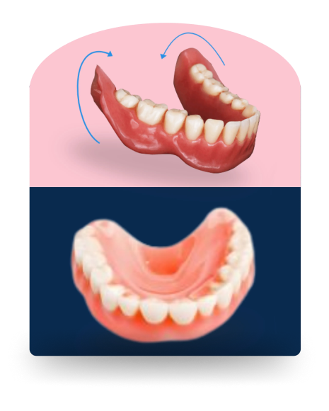 Suction Denture