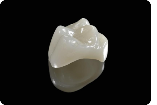 Why Crowns and Bridges?