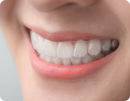 Why Invisalign? Why Invisalign?