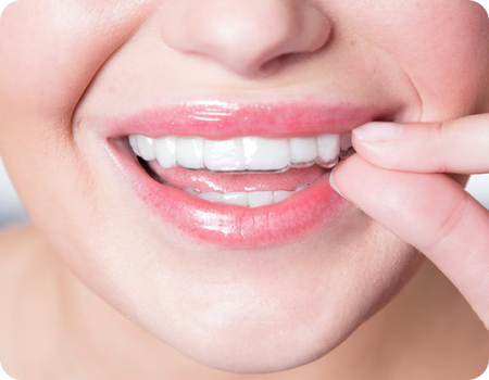 Why Invisalign? Why Invisalign?