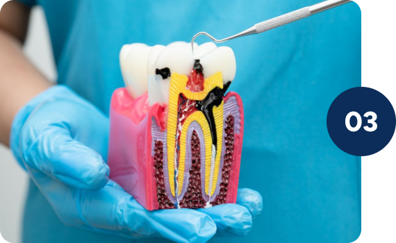 Restores chewing strength