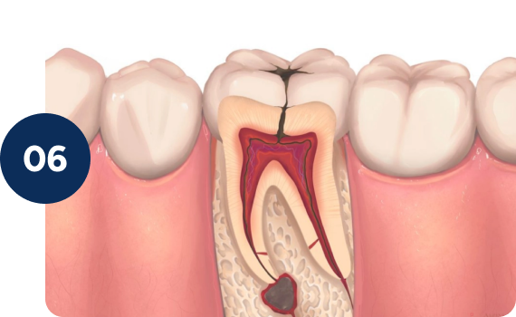 Increases long-term success of the RCT
