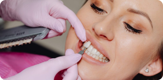 Why Porcelain Veneers? Why Porcelain Veneers?