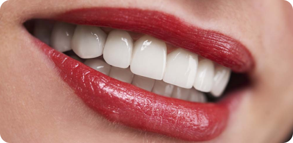 Why Porcelain Veneers? Why Porcelain Veneers?