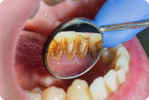 Why Scaling? Why Scaling?