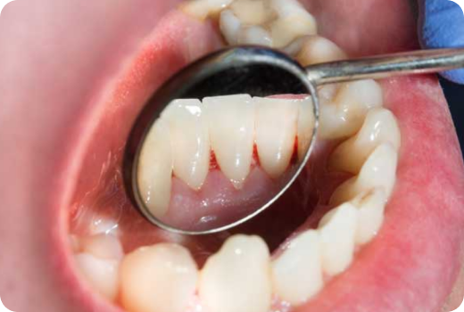 Why Scaling? Why Scaling?