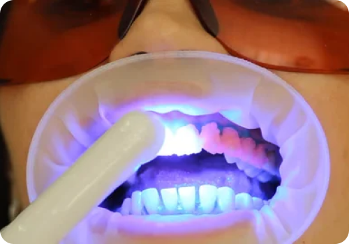 Why Whitening?