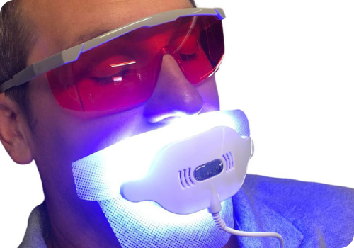 Why Whitening?