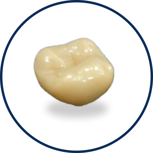 Zirconia/Glass Ceramic