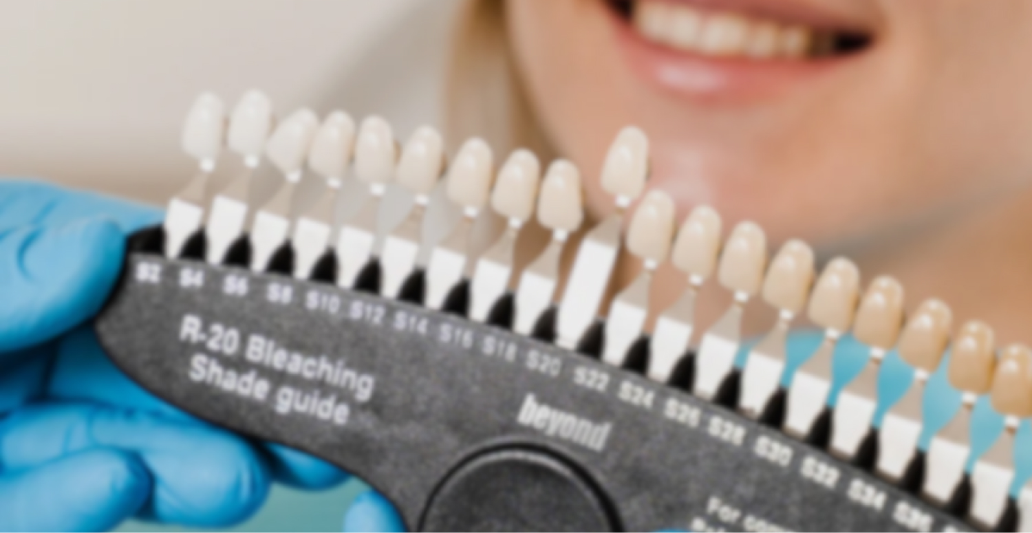 Mobile :: Subpage Masthead :: Teeth Whitening